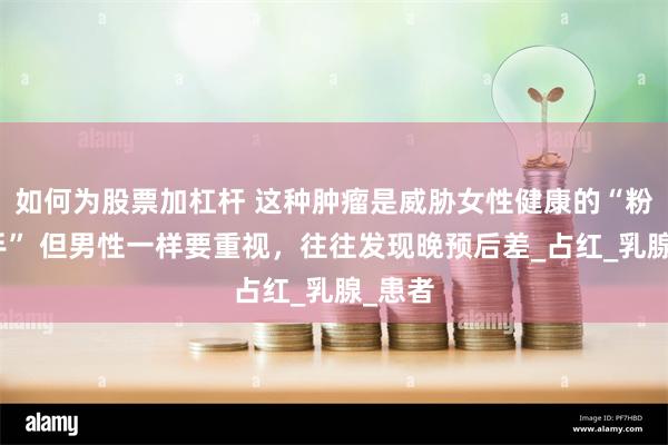 如何为股票加杠杆 这种肿瘤是威胁女性健康的“粉红杀手” 但男性一样要重视，往往发现晚预后差_占红_乳腺_患者